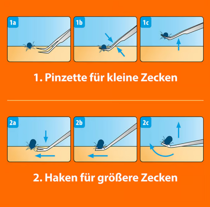 ARDAP 2-in-1 Zeckenhaken aus Edelstahl