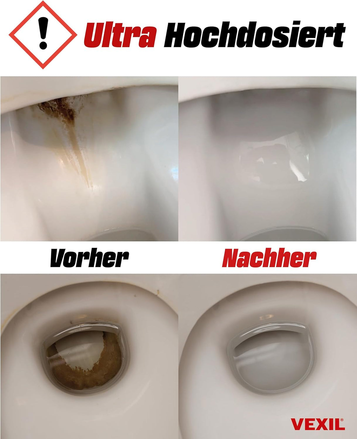 🚽 VEXIL® Urinsteinentferner 1 L