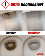 🚽 VEXIL® Urinsteinentferner 1 L